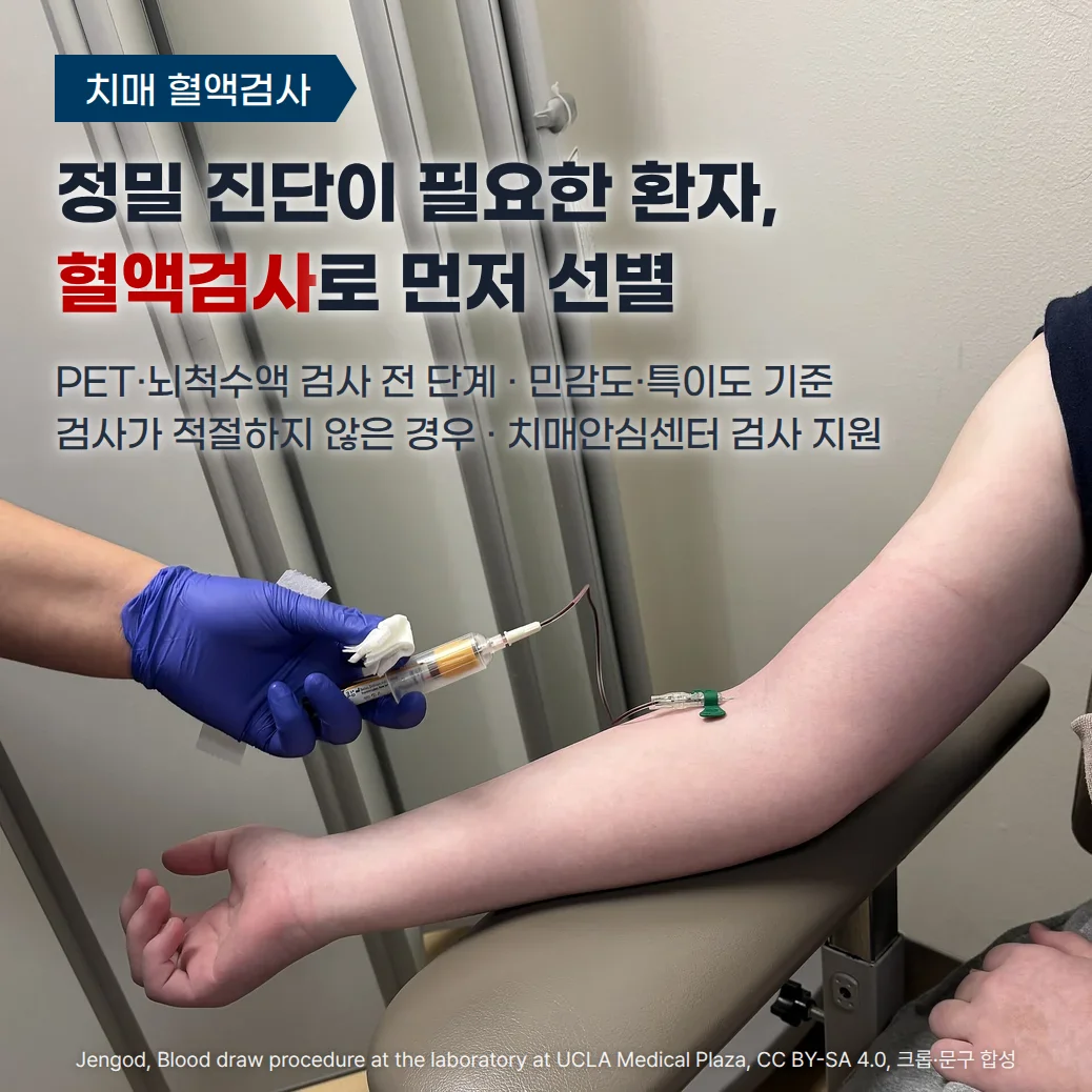 채혈실 의자 팔걸이에 올린 팔에서 진공 채혈관으로 혈액을 채취하는 사진 위에 '치매 혈액검사' 배지와 '정밀 진단이 필요한 환자, 혈액검사로 먼저 선별' 제목, 'PET·뇌척수액 검사 전 단계 · 민감도·특이도 기준 · 검사가 적절하지 않은 경우 · 치매안심센터 검사 지원' 부제가 놓인 커버