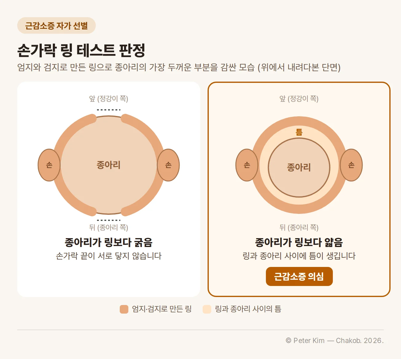 손가락 링 테스트 판정 그림. 엄지와 검지로 만든 링으로 종아리의 가장 두꺼운 부분을 감싼 모습을 위에서 내려다본 단면 두 개. 종아리가 링보다 굵으면 손가락 끝이 서로 닿지 않고, 종아리가 링보다 얇으면 링과 종아리 사이에 틈이 생기며 이 경우 근감소증 의심