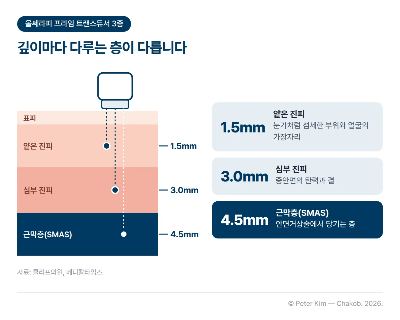 피부 단면을 위에서 아래로 표피, 얕은 진피, 심부 진피, 근막층으로 나눈 도식입니다. 1.5mm 초점은 얕은 진피로 눈가처럼 섬세한 부위와 얼굴의 가장자리, 3.0mm 초점은 심부 진피로 중안면의 탄력과 결, 4.5mm 초점은 근막층(SMAS)으로 안면거상술에서 당기는 층을 다룹니다.