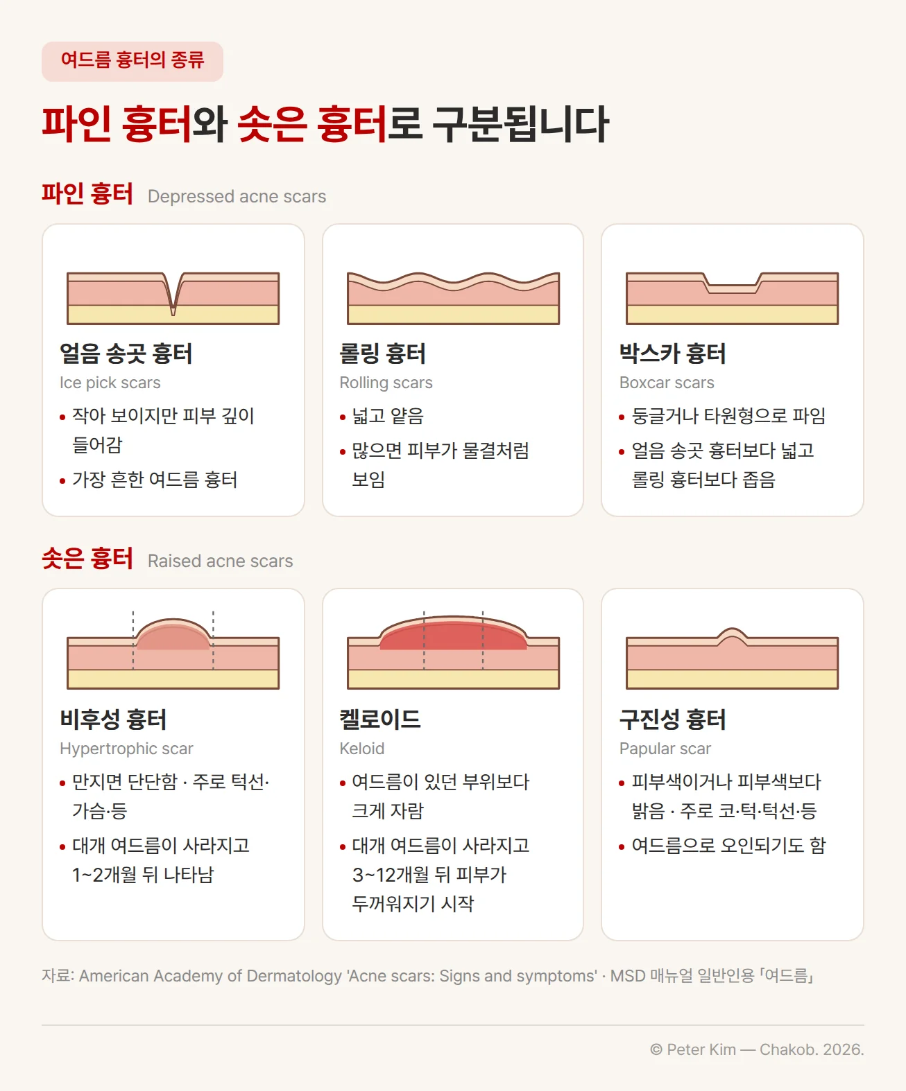 여드름 흉터의 종류를 파인 흉터와 솟은 흉터 두 줄로 나눈 카드 도식. 파인 흉터는 작아 보이지만 피부 깊이 들어가는 가장 흔한 얼음 송곳 흉터, 넓고 얕아 많으면 피부가 물결처럼 보이는 롤링 흉터, 둥글거나 타원형으로 파인 박스카 흉터입니다. 솟은 흉터는 만지면 단단하고 주로 턱선·가슴·등에 생기고 대개 여드름이 사라지고 1~2개월 뒤 나타나는 비후성 흉터, 여드름이 있던 부위보다 크게 자라고 대개 3~12개월 뒤 피부가 두꺼워지기 시작하는 켈로이드, 피부색이거나 더 밝고 주로 코·턱·턱선·등에 생겨 여드름으로 오인되기도 하는 구진성 흉터입니다