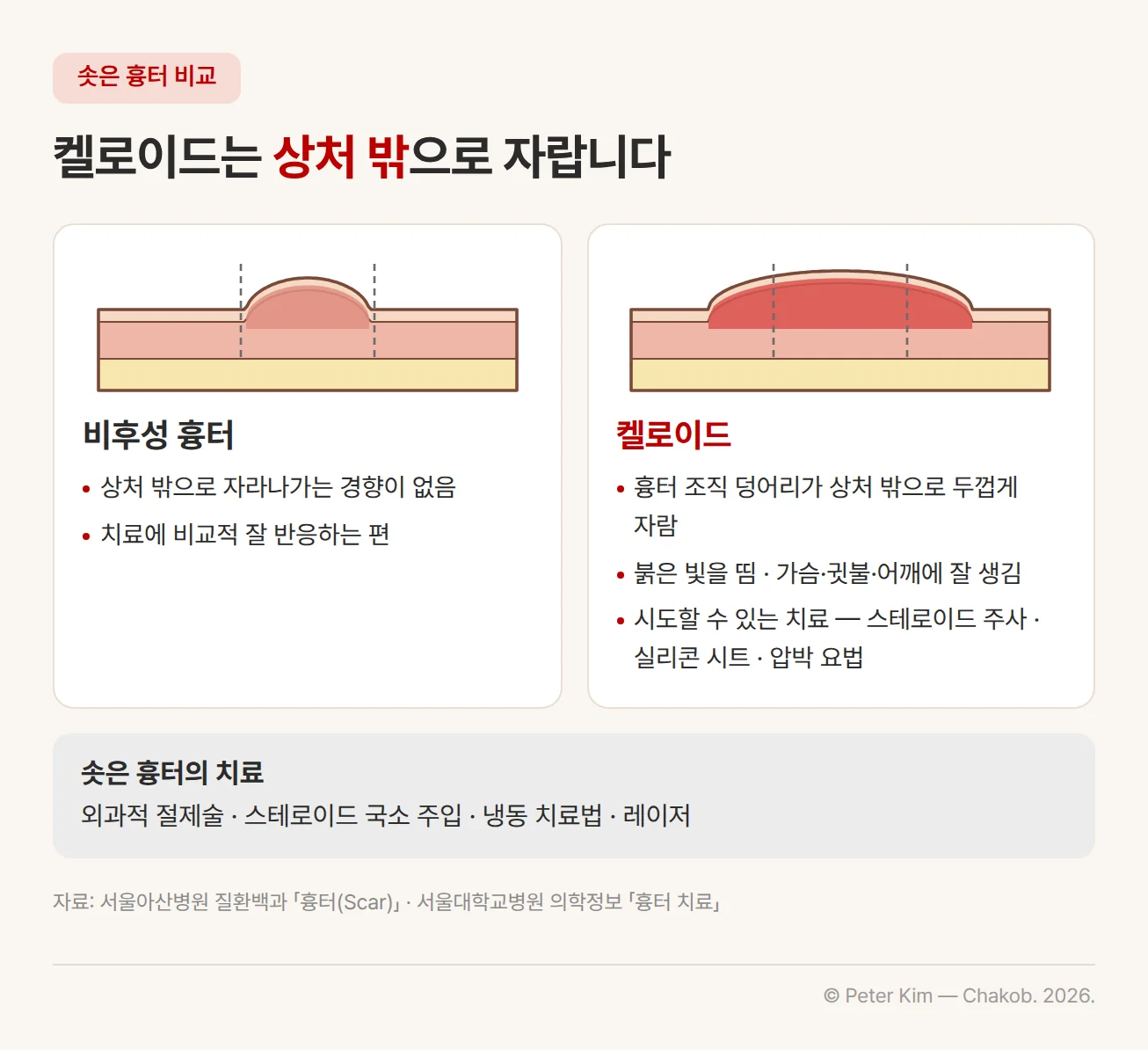 비후성 흉터와 켈로이드 비교 카드. 비후성 흉터는 상처 밖으로 자라나가는 경향이 없고 치료에 비교적 잘 반응하는 편입니다. 켈로이드는 흉터 조직 덩어리가 상처 밖으로 두껍게 자라고 붉은 빛을 띠며 가슴·귓불·어깨에 잘 생기고, 스테로이드 주사·실리콘 시트·압박 요법을 시도할 수 있습니다. 아래 띠에 솟은 흉터는 외과적 절제술·스테로이드 국소 주입·냉동 치료법·레이저로 치료한다는 내용이 있습니다
