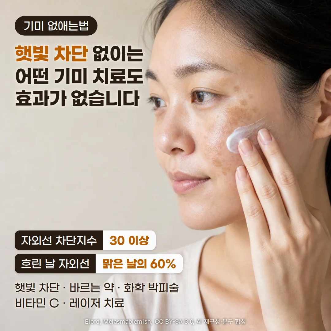 밝은 베이지 벽 앞에서 광대와 뺨에 갈색 기미가 있는 여성이 손끝으로 뺨에 흰 자외선 차단제를 바르는 사진. 왼쪽에 기미 없애는법, 햇빛 차단 없이는 어떤 기미 치료도 효과가 없습니다, 자외선 차단지수 30 이상, 흐린 날 자외선 맑은 날의 60%, 햇빛 차단 · 바르는 약 · 화학 박피술 · 비타민 C · 레이저 치료라는 문구가 있습니다