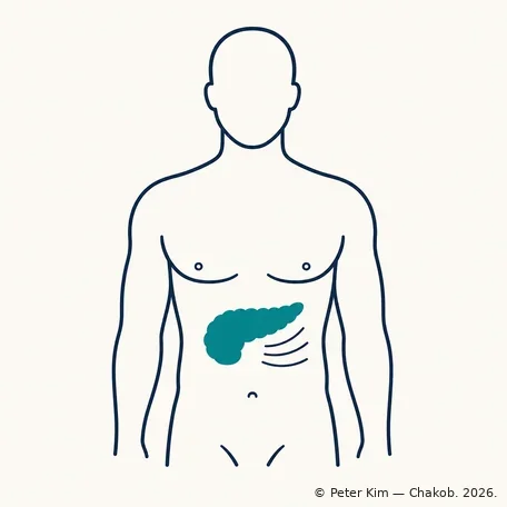 몸통 윤곽 안 윗배에 췌장 위치를 표시하고 등 쪽으로 퍼지는 통증 선을 그린 단순 아이콘