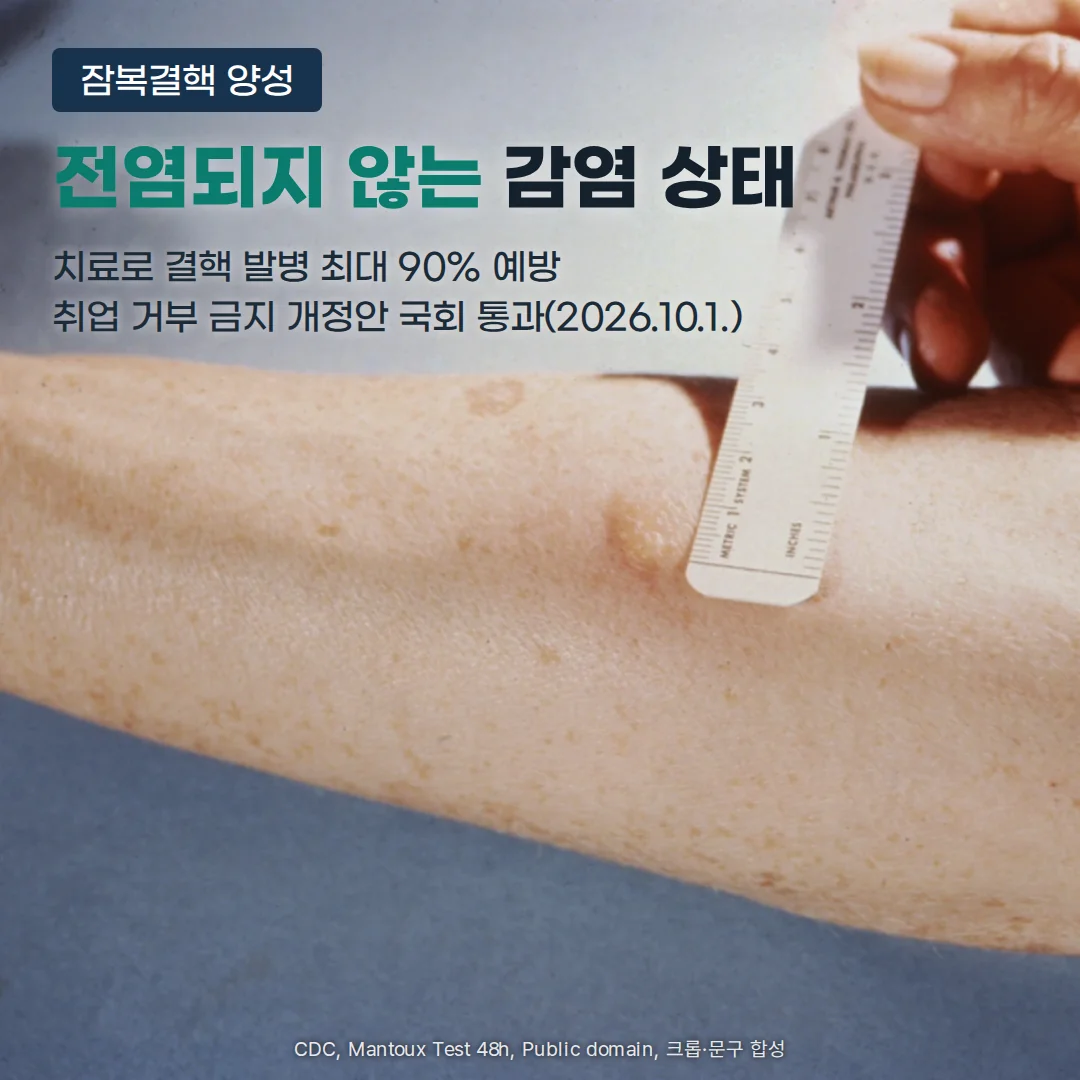 투베르쿨린 피부반응검사 뒤 팔뚝에 부풀어 오른 경결의 크기를 자로 재는 사진 위에 '잠복결핵 양성' 배지, '전염되지 않는 감염 상태' 제목, '치료로 결핵 발병 최대 90% 예방', '취업 거부 금지 개정안 국회 통과(2026.10.1.)' 문구