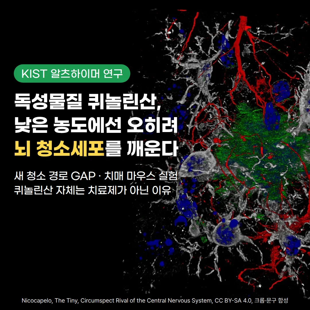 검은 바탕에서 초록색 베타아밀로이드 플라크를 회색 미세아교세포와 성상세포가 둘러싸고 붉은색·파란색 구조가 함께 보이는 현미경 이미지 위에 'KIST 알츠하이머 연구' 배지, '독성물질 퀴놀린산, 낮은 농도에선 오히려 뇌 청소세포를 깨운다' 제목, '새 청소 경로 GAP · 치매 마우스 실험, 퀴놀린산 자체는 치료제가 아닌 이유' 부제가 있는 커버 이미지