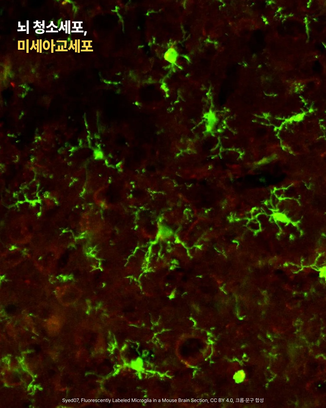 마우스 뇌 절편의 미세아교세포를 초록색 형광으로 염색한 현미경 사진입니다. 어두운 적갈색 바탕에 가지를 사방으로 뻗은 초록색 세포들이 고르게 흩어져 있습니다. 위쪽에 '뇌 청소세포, 미세아교세포'라는 글자가 놓여 있습니다.